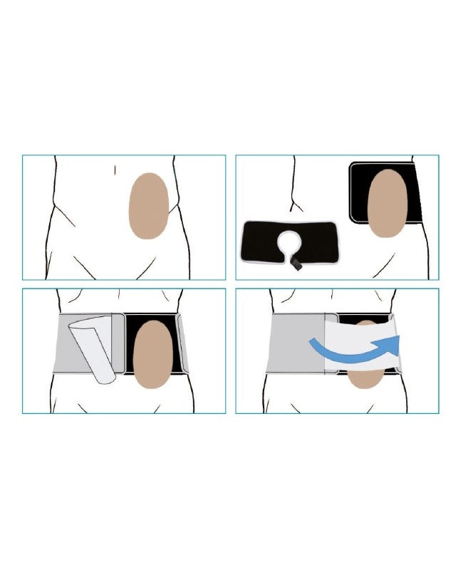 Cinturón para Ostomia Orione Ref.3052 - Altura 16 cm.